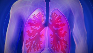 COPD And Emphysema Treatment
